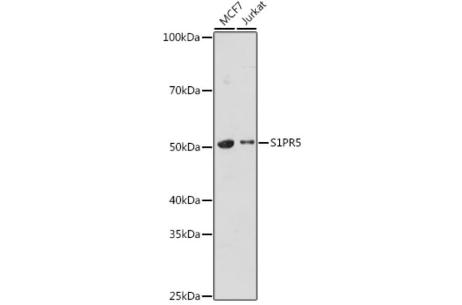 Western Blot - Anti-EDG8 Antibody (A308932) - Antibodies.com