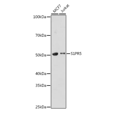 Western Blot - Anti-EDG8 Antibody (A308932) - Antibodies.com