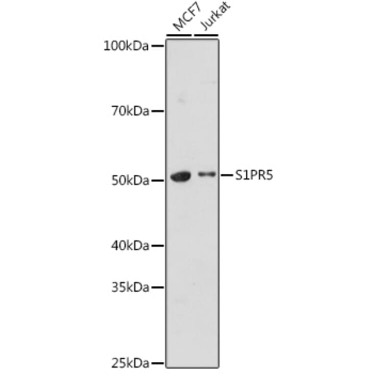 Western Blot - Anti-EDG8 Antibody (A308932) - Antibodies.com