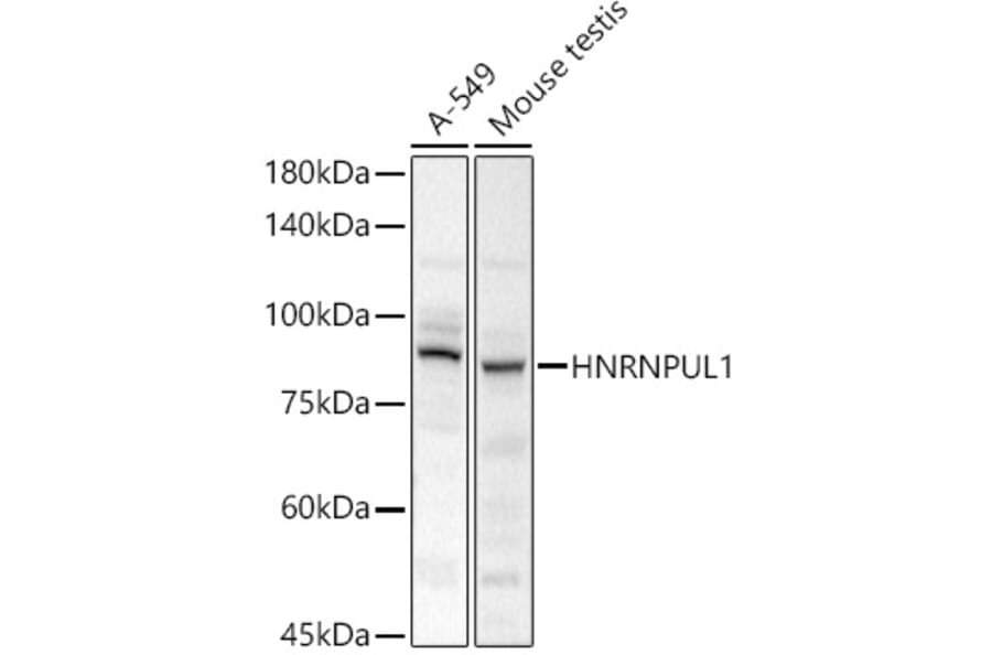 Western Blot - Anti-HADHA Antibody (A308933) - Antibodies.com