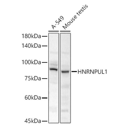 Western Blot - Anti-HADHA Antibody (A308933) - Antibodies.com