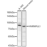 Western Blot - Anti-HADHA Antibody (A308933) - Antibodies.com