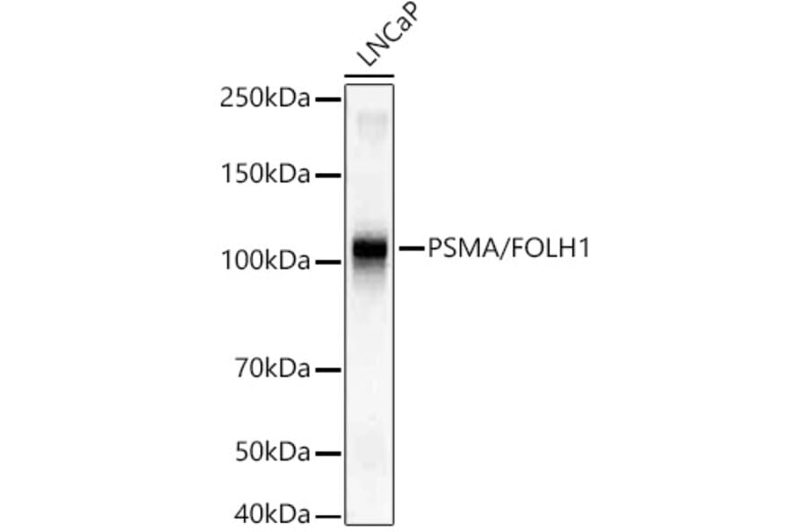 Western Blot - Anti-PSMA Antibody [ARC56326] (A308936) - Antibodies.com