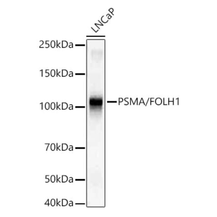 Western Blot - Anti-PSMA Antibody [ARC56326] (A308936) - Antibodies.com