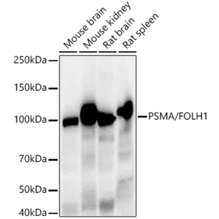 Western Blot - Anti-PSMA Antibody [ARC56326] (A308936) - Antibodies.com