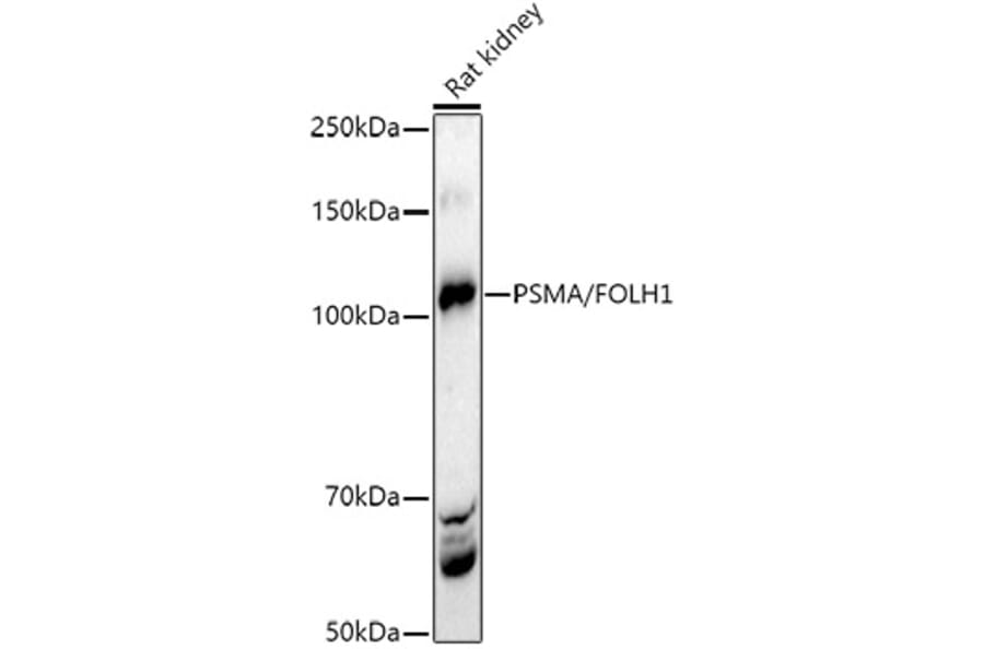 Western Blot - Anti-PSMA Antibody (A308937) - Antibodies.com
