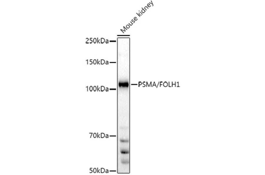 Western Blot - Anti-PSMA Antibody (A308937) - Antibodies.com