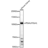 Western Blot - Anti-PSMA Antibody (A308937) - Antibodies.com