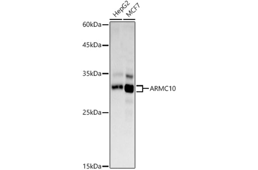 Western Blot - Anti-SVH Antibody (A308938) - Antibodies.com
