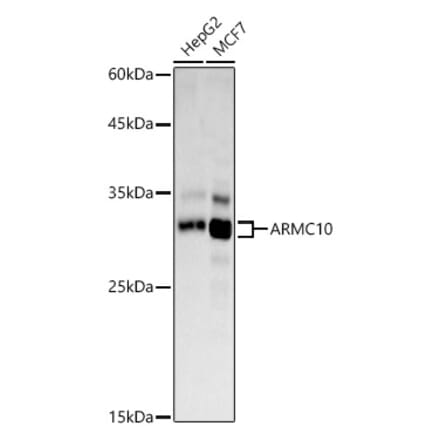 Western Blot - Anti-SVH Antibody (A308938) - Antibodies.com