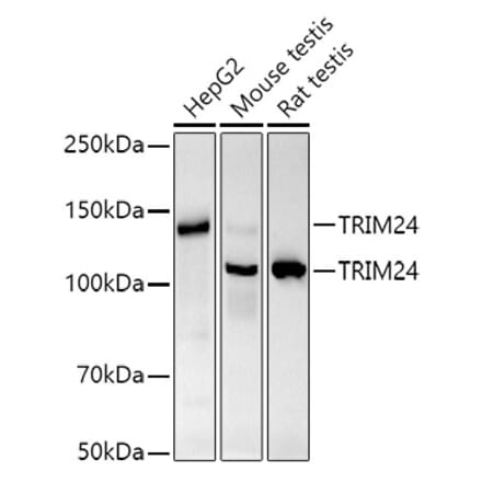 Western Blot - Anti-TRIM24 Antibody [ARC2920] (A308939) - Antibodies.com