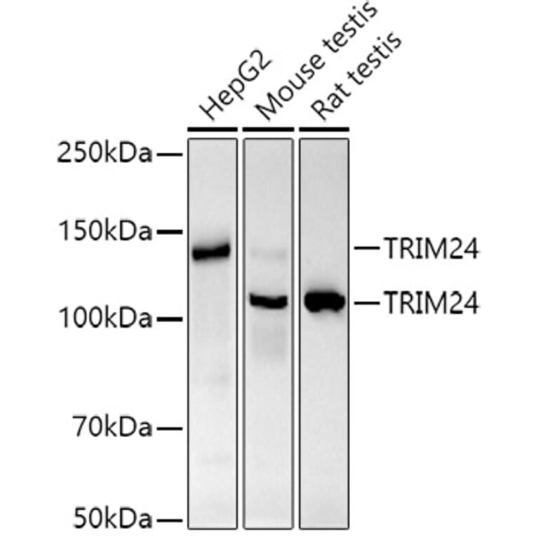 Western Blot - Anti-TRIM24 Antibody [ARC2920] (A308939) - Antibodies.com