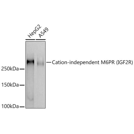 Western Blot - Anti-M6PR (cation independent) Antibody [ARC51203] (A308940) - Antibodies.com