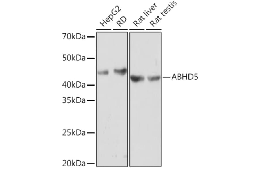 Western Blot - Anti-Abhd5/CGI-58 Antibody [ARC1777] (A308941) - Antibodies.com