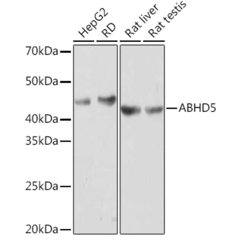 Western Blot - Anti-Abhd5/CGI-58 Antibody [ARC1777] (A308941) - Antibodies.com