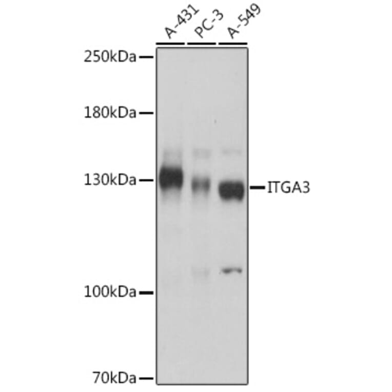 Western Blot - Anti-Integrin alpha 3 Antibody (A308942) - Antibodies.com