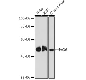 Western Blot - Anti-PAX6 Antibody [ARC2646] (A308943) - Antibodies.com