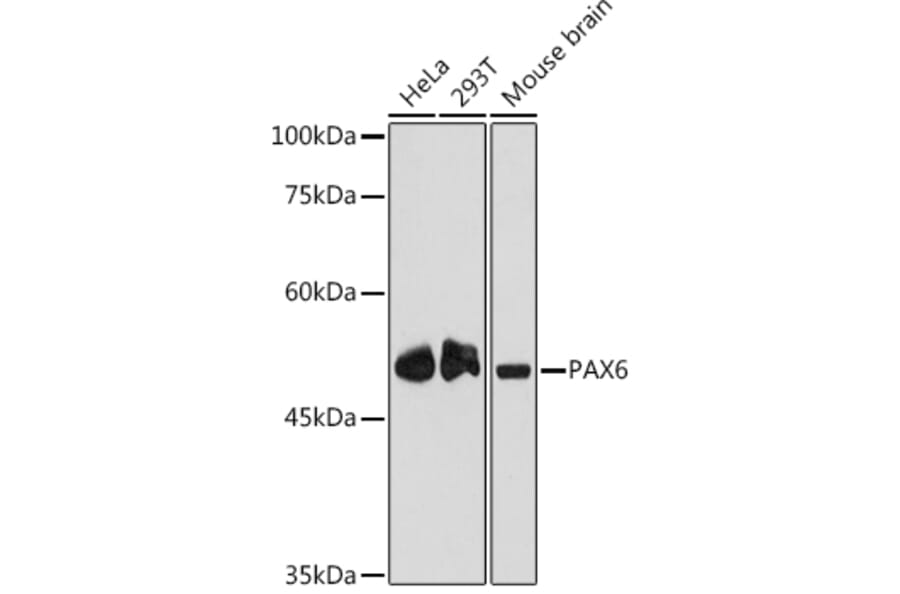 Western Blot - Anti-PAX6 Antibody [ARC2646] (A308943) - Antibodies.com
