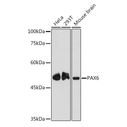 Western Blot - Anti-PAX6 Antibody [ARC2646] (A308943) - Antibodies.com