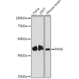 Western Blot - Anti-PAX6 Antibody [ARC2646] (A308943) - Antibodies.com