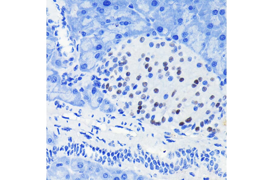 Immunohistochemistry - Anti-PAX6 Antibody [ARC2646] (A308943) - Antibodies.com