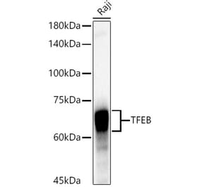 Western Blot - Anti-TFEB Antibody [ARC53777] (A308944) - Antibodies.com