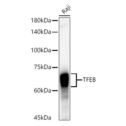 Western Blot - Anti-TFEB Antibody [ARC53777] (A308944) - Antibodies.com
