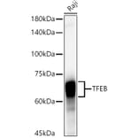 Western Blot - Anti-TFEB Antibody [ARC53777] (A308944) - Antibodies.com