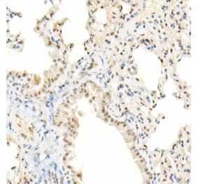 Immunohistochemistry - Anti-TFEB Antibody [ARC53778] (A308945) - Antibodies.com