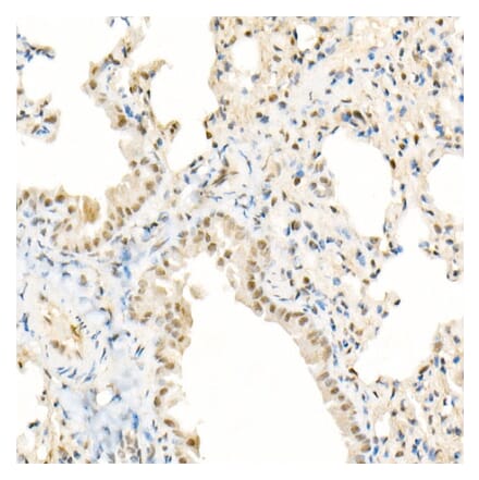 Immunohistochemistry - Anti-TFEB Antibody [ARC53778] (A308945) - Antibodies.com