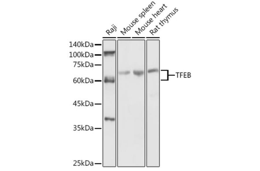 Western Blot - Anti-SHMT2/SHMT Antibody (A308946) - Antibodies.com