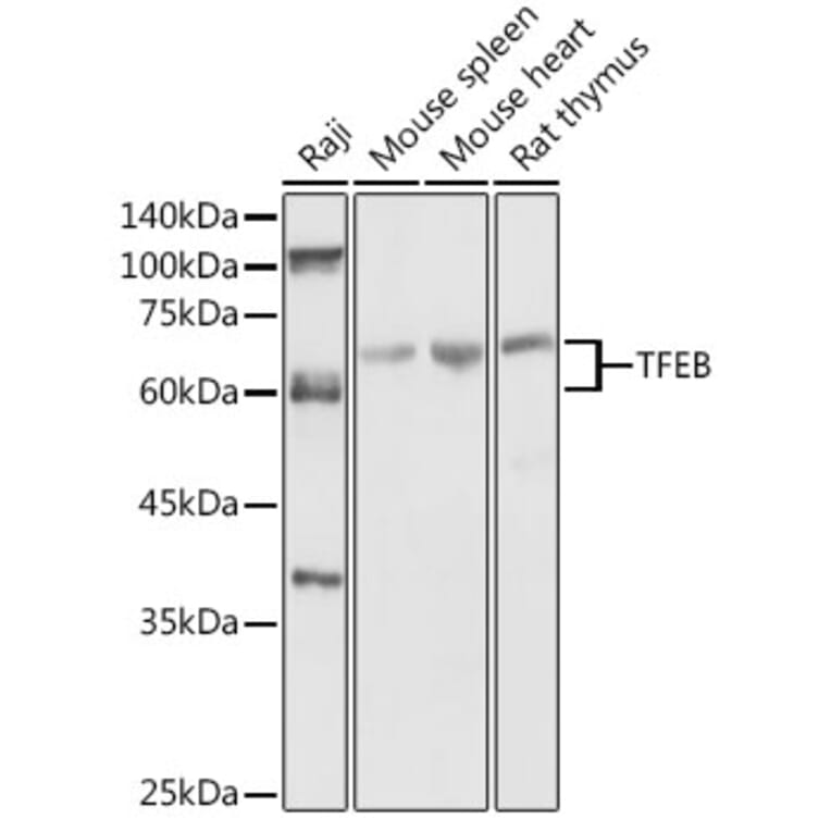 Western Blot - Anti-SHMT2/SHMT Antibody (A308946) - Antibodies.com