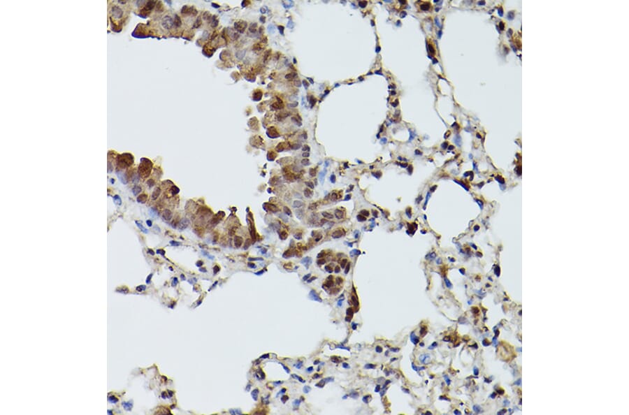 Immunohistochemistry - Anti-SHMT2/SHMT Antibody (A308946) - Antibodies.com