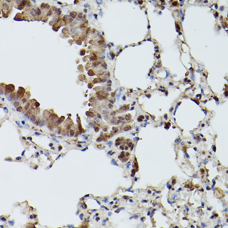 Immunohistochemistry - Anti-SHMT2/SHMT Antibody (A308946) - Antibodies.com