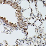 Immunohistochemistry - Anti-SHMT2/SHMT Antibody (A308946) - Antibodies.com