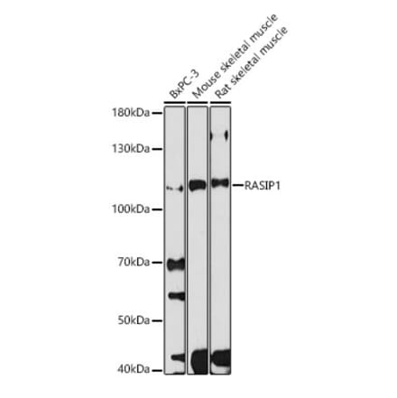 Western Blot - Anti-RAIN Antibody (A308948) - Antibodies.com