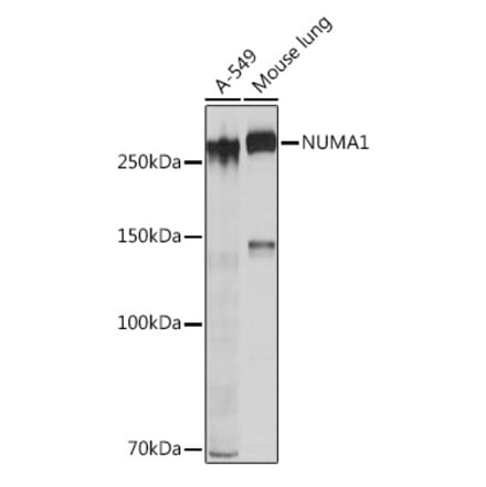 Western Blot - Anti-NuMA Antibody [ARC1000] (A308949) - Antibodies.com