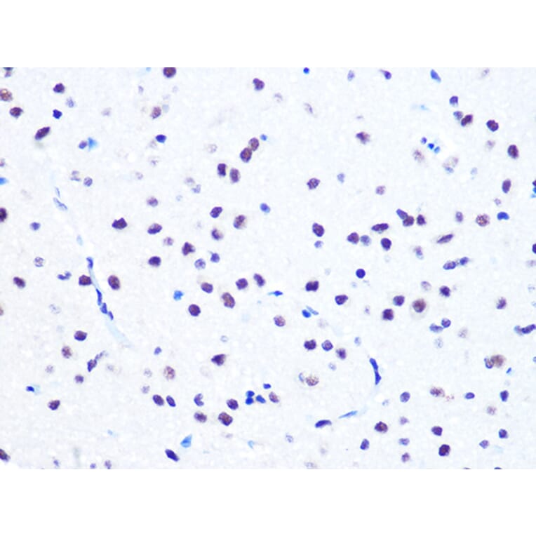 Immunohistochemistry - Anti-NuMA Antibody [ARC1000] (A308949) - Antibodies.com