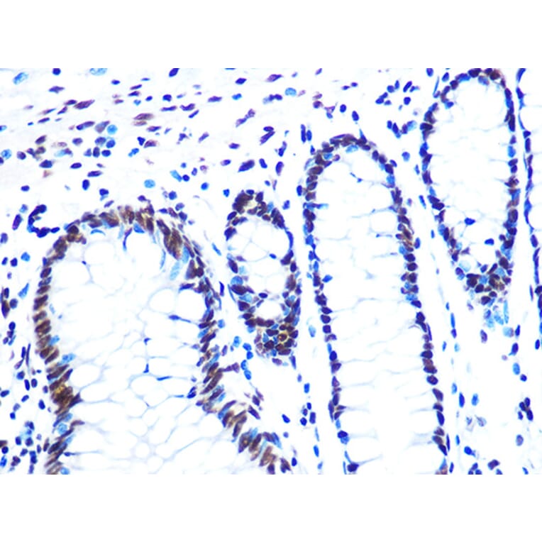 Immunohistochemistry - Anti-NuMA Antibody [ARC1000] (A308949) - Antibodies.com