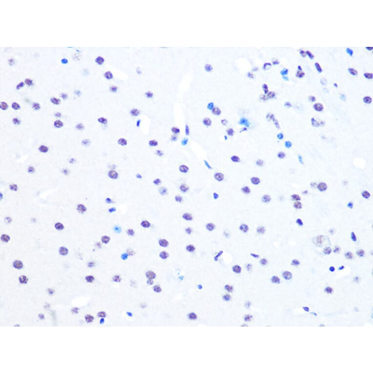 Immunohistochemistry - Anti-NuMA Antibody [ARC1000] (A308949) - Antibodies.com