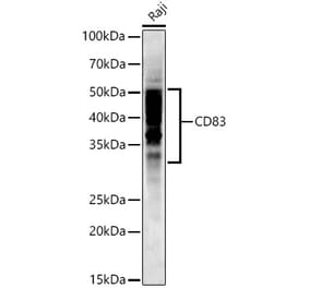 Western Blot - Anti-CD83 Antibody [ARC53759] (A308950) - Antibodies.com
