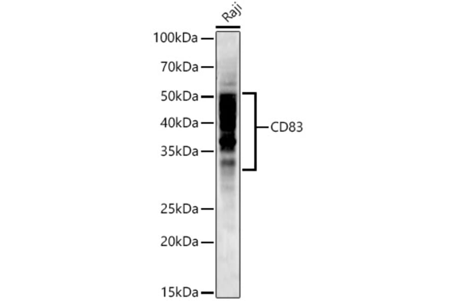 Western Blot - Anti-CD83 Antibody [ARC53759] (A308950) - Antibodies.com
