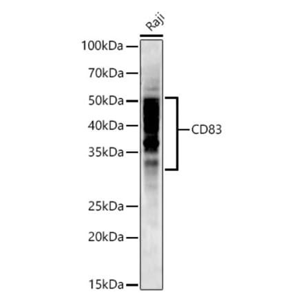 Western Blot - Anti-CD83 Antibody [ARC53759] (A308950) - Antibodies.com