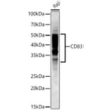 Western Blot - Anti-CD83 Antibody [ARC53759] (A308950) - Antibodies.com