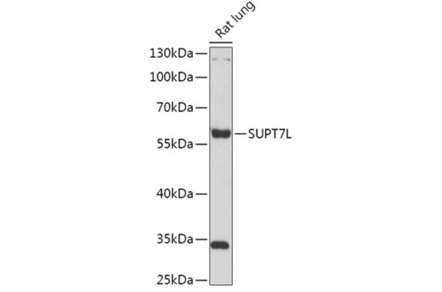 Western Blot - Anti-SUPT7L Antibody (A308951) - Antibodies.com