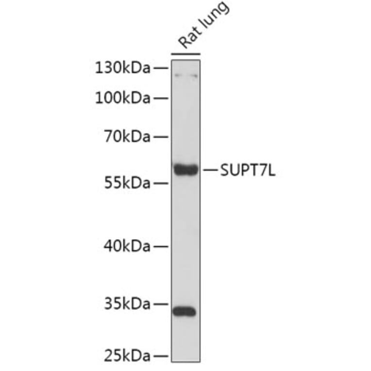 Western Blot - Anti-SUPT7L Antibody (A308951) - Antibodies.com