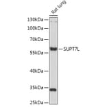 Western Blot - Anti-SUPT7L Antibody (A308951) - Antibodies.com