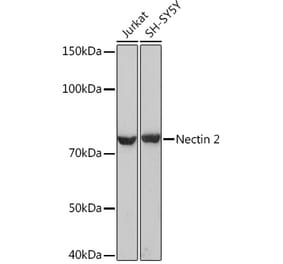 Western Blot - Anti-Nectin 2 Antibody [ARC1665] (A308952) - Antibodies.com