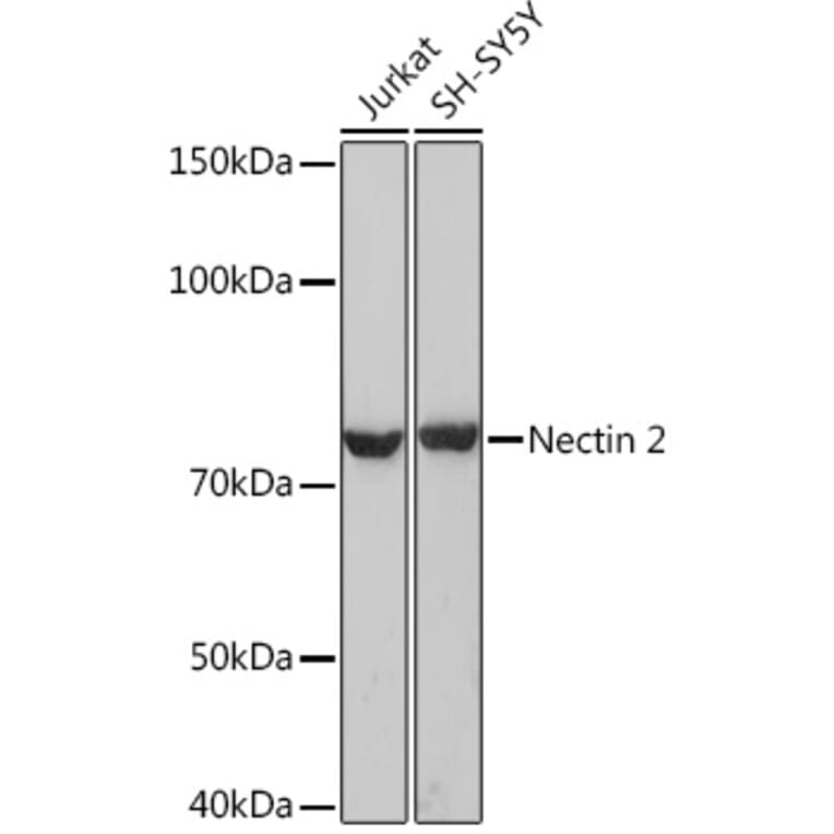 Western Blot - Anti-Nectin 2 Antibody (A308952) - Antibodies.com