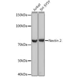 Western Blot - Anti-Nectin 2 Antibody (A308952) - Antibodies.com